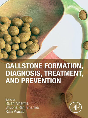 cover image of Gallstone Formation, Diagnosis, Treatment and Prevention